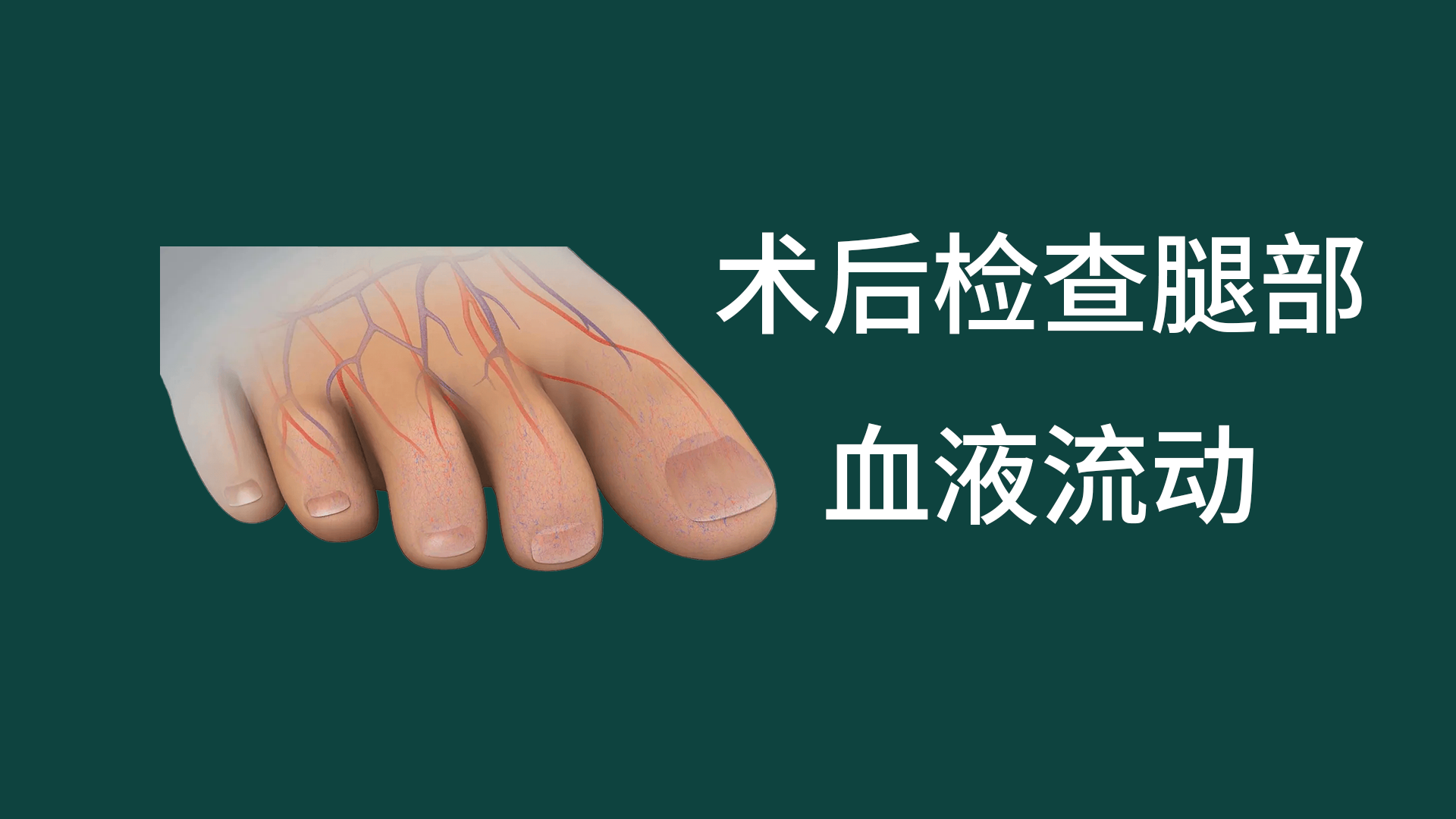 手术后如何检查腿部的血液流动