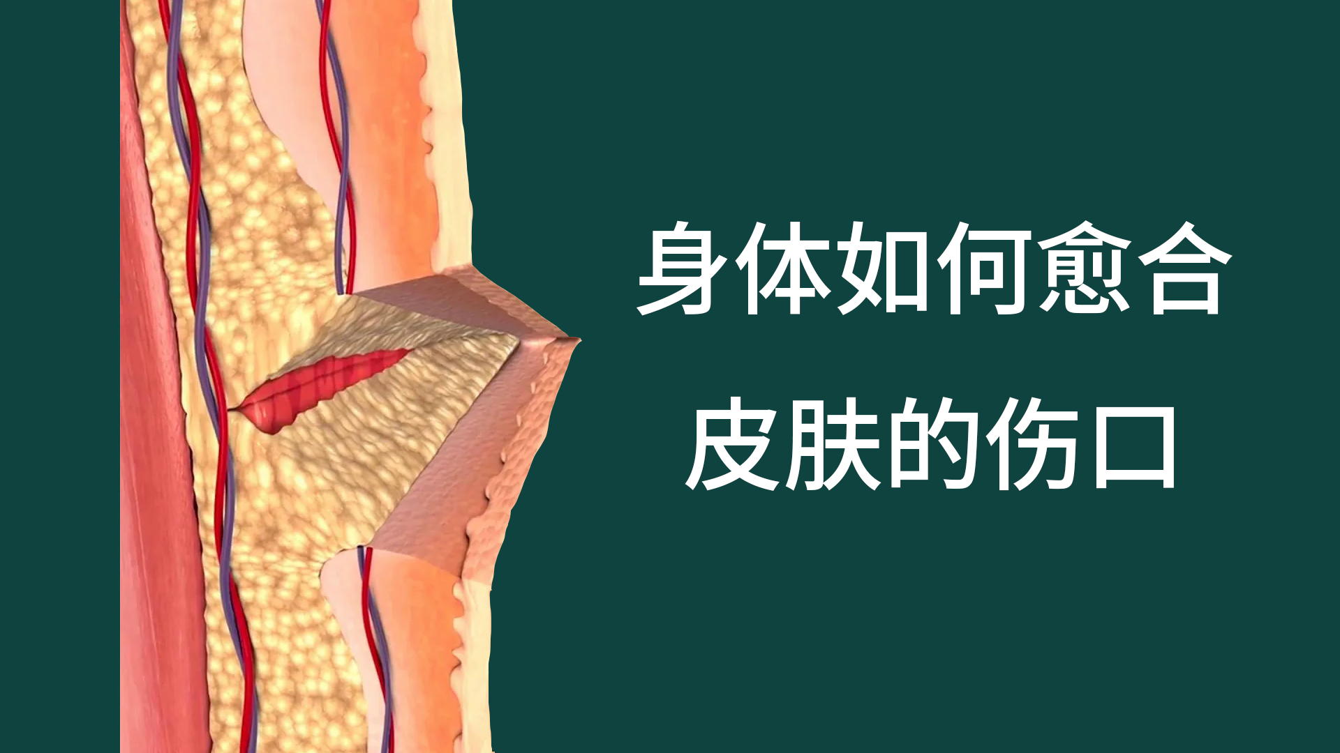 身体如何愈合皮肤上的伤口