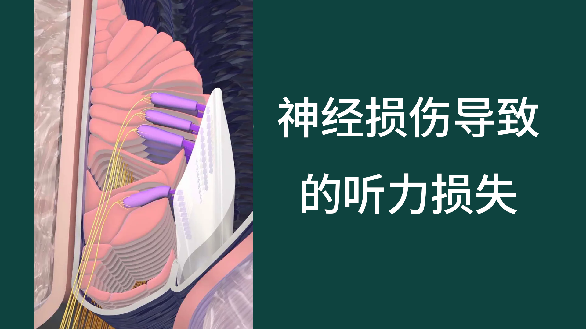 神经损伤导致的听力损失